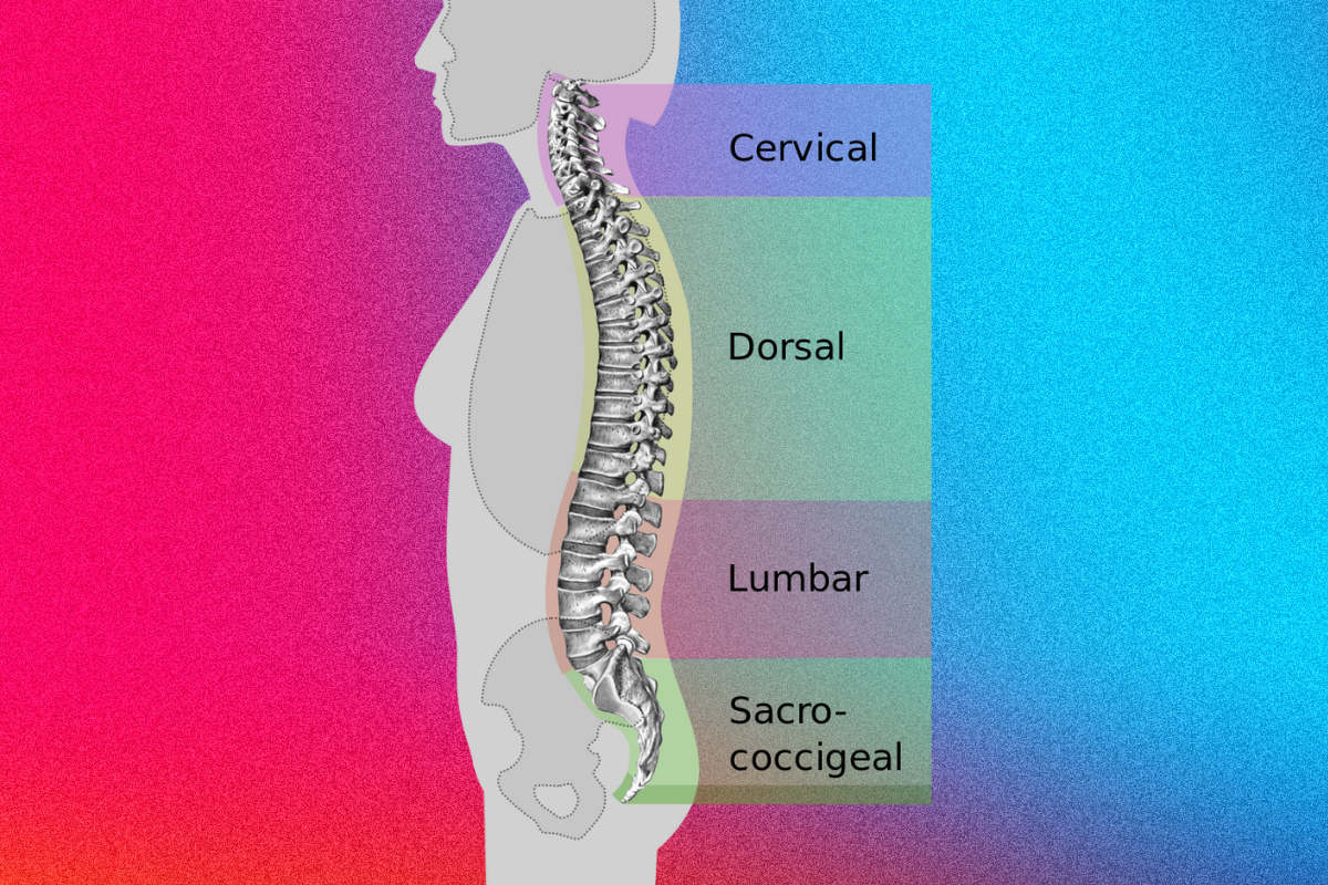 scoliosis